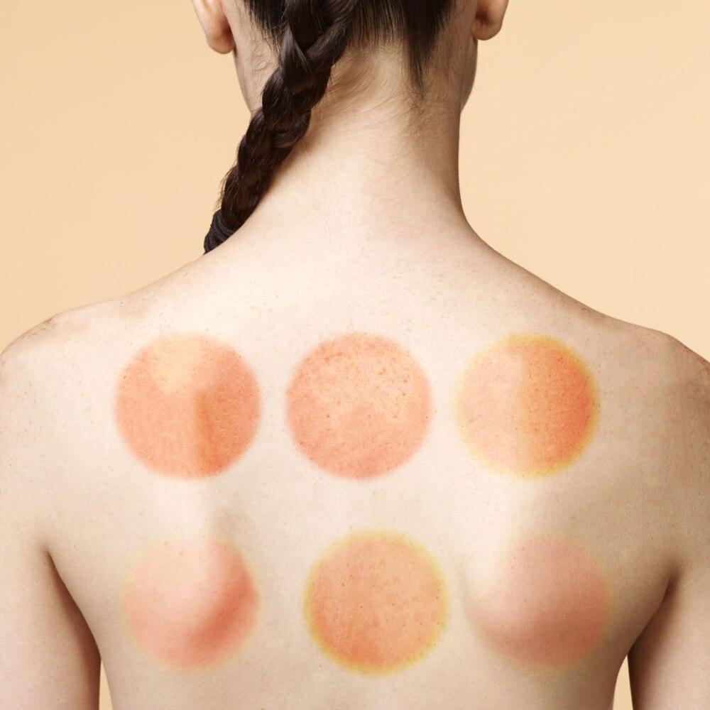 CupsTherapy™ - Therapy Cupping Set - Wellnessandcomfort.com